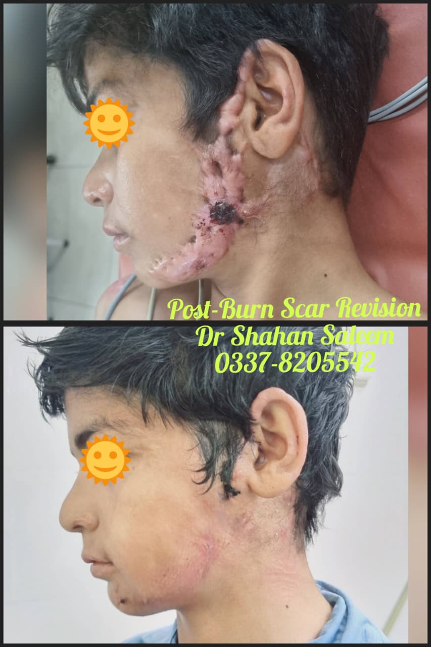 Before & After 5